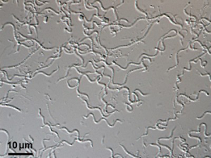 サハラ砂漠で新しい「綱」の微生物を発見―従来の分類超え、「オリゴフレキシア綱」と命名：広島大学/筑波大学/テクノスルガ・ラボほか （旧
