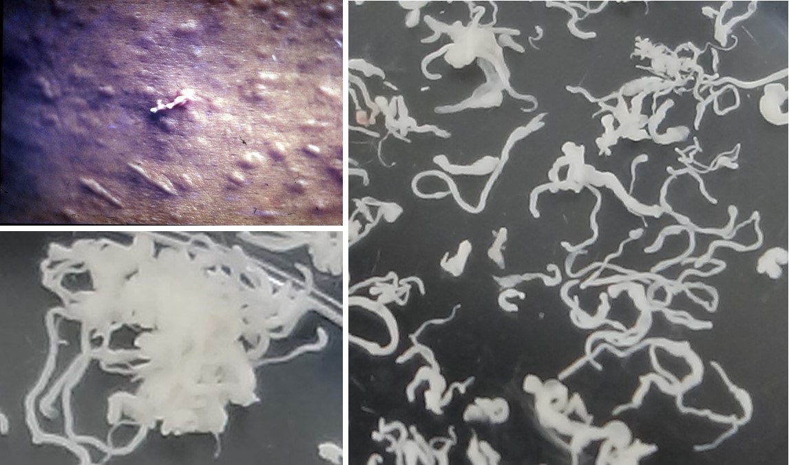 ガンは伝染する! : 恐るべき寄生虫症の真相 ガンは伝染する! : 恐るべき寄生虫症の真相(笹川英資 著) / るび